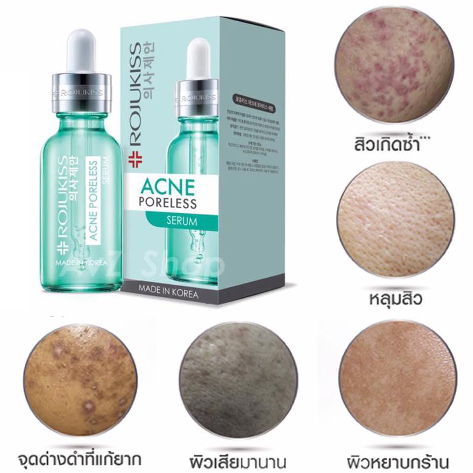 Rojukiss, Rojukiss Acne Poreless Serum, Rojukiss Acne Poreless Serum รีวิว, Rojukiss Acne Poreless Serum ราคา, Rojukiss Acne Poreless Serum pantip, Acne Poreless Serum, Rojukiss Acne Poreless Serum 5ml, เซรั่ม, โรจูคิส, สิว, ผิวมัน